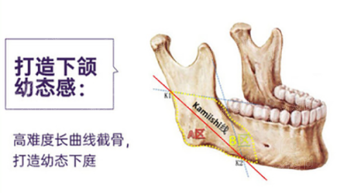 五、为何选择厦门云艺美？从预约到服务的全程优势解读