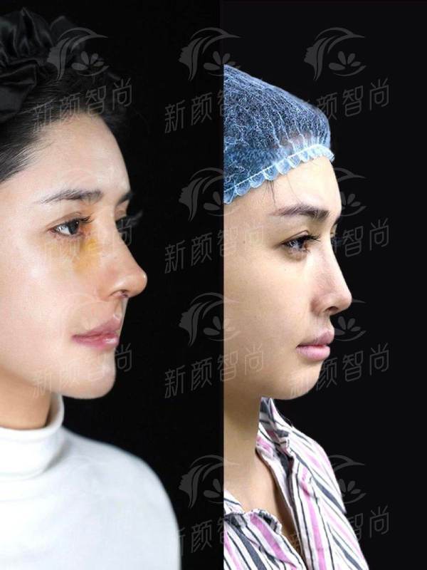 五、一站式美丽攻略:如何预约及项目价格参考(2026年参考)
