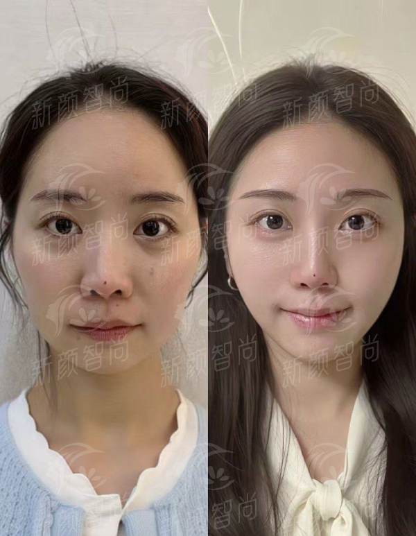 二、揭秘凝美核心技术:骨干医生团队与“自然妈生感”美学