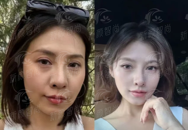 四、陕西中 医 药大学附属医院(美容科):项目齐全透明,满足多元变得更美需求