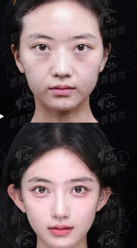 三、 杭州市第一人民医院钱江新城院区(医学美容科):特色项目深度解读,满足多元需求
