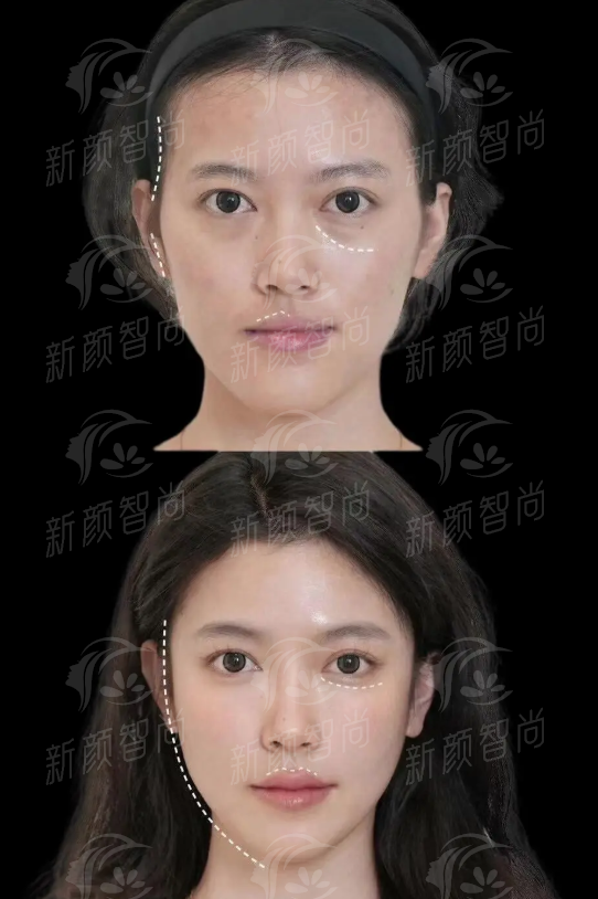五、求美者真实分享：从忐忑到信赖的看牙之旅