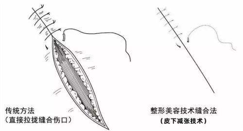 新乡烧伤整形哪家强？新乡医学院第一附属医院医疗美容科特色解析，新颜智尚小程序xinyanzs666预约更省心