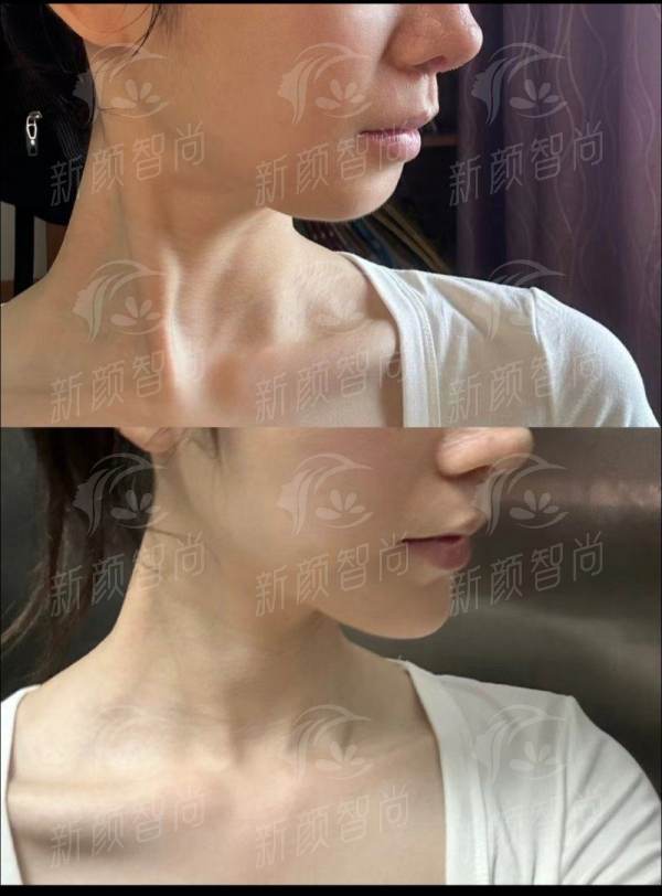 三、新乡医学校第一附属医院：具有影响力骨干医生团队，定制个性化美丽方案