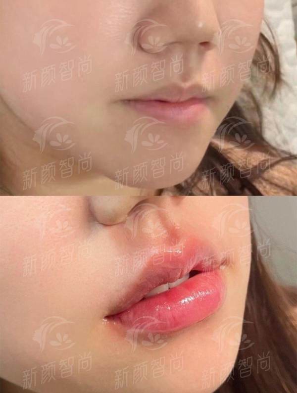 大连眼修复找宋立男医生靠谱吗？机构地址&价格表&风格优势大公开，线上预约挂号已开启，-新颜智尚小程序一键预约！