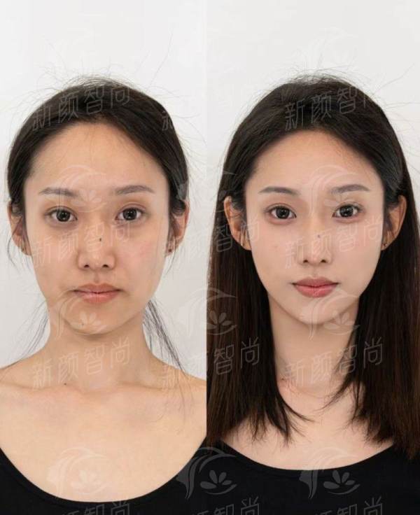 杭州郭皓唇腭裂整形怎么样？价格表+案例分享，机构地址&特色项目大揭秘！-新颜智尚小程序一键预约！