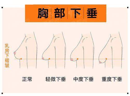 四、兰州维多丽亚整形:求美者真实分享与口碑见证