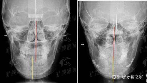 三、 为什么选择媚思嘉？多维优势深度解析