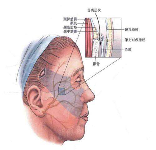 二、 广州紫馨整形的核心技术：不止于“做手术”