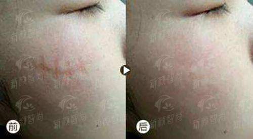 二、河南洛阳孔繁荣医疗美容门诊部：设备矩阵，“全维抗衰”的硬核实力