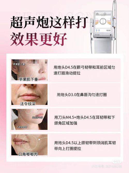 四、顾客心声：来自不同角度的满意分享