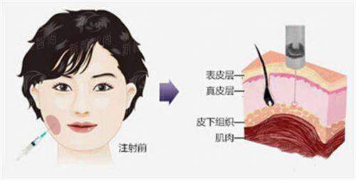 四、赤峰张安凤医疗美容门诊:项目与价格,透明消费开启美丽计划