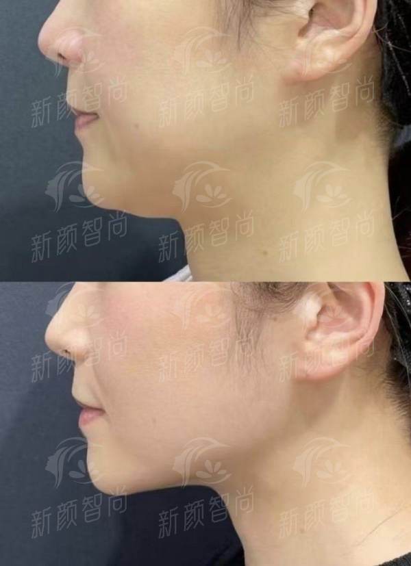 三、 探秘广州紫馨整形的“梦之队”与高奢艺术空间