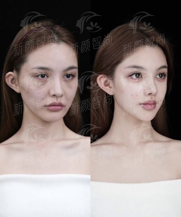 五、求美者说：听听她们在东莞吉美中科医美的真实蜕变故事