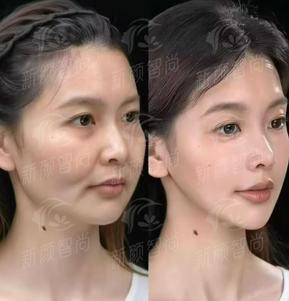 二、赤峰张安凤医疗美容门诊:服务与环境,如何重新定义“医美体验”?