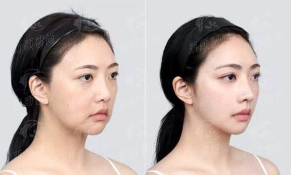五、哈尔滨艺星医疗美容医院：来自求美者的真实声音与满意实例分享