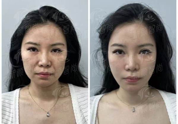 五、合肥智善美医美整形服务、环境与透明收费