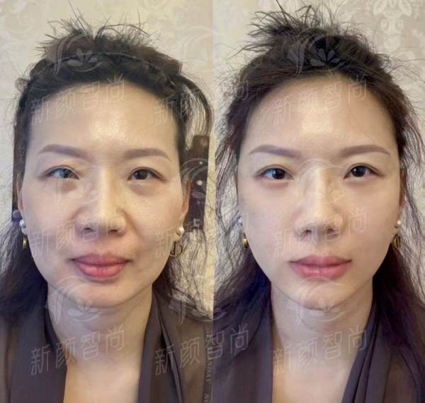 青岛旎尔医疗美容怎么样？口碑与价格全解析，附新颜智尚小程序线上预约挂号已开启