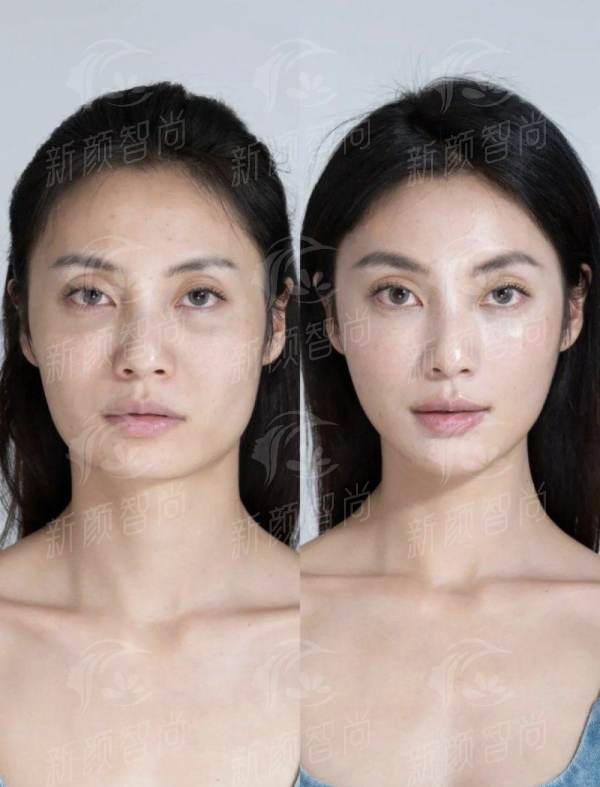 五、<strong>太原美兮医疗美容诊所</strong>:真实顾客实例分享,听听她们怎么说