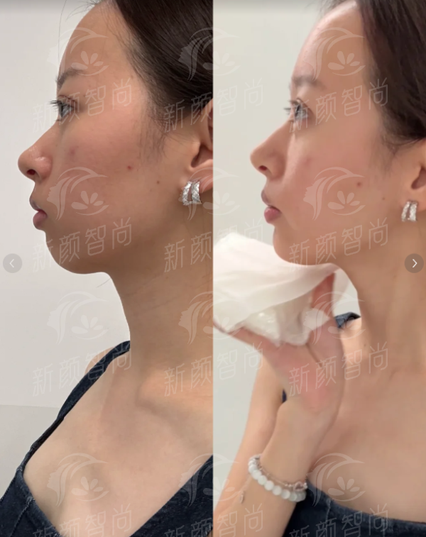 三、<strong>太原美兮医疗美容诊所</strong>:严选5-10年经验医生,技术实力硬碰硬