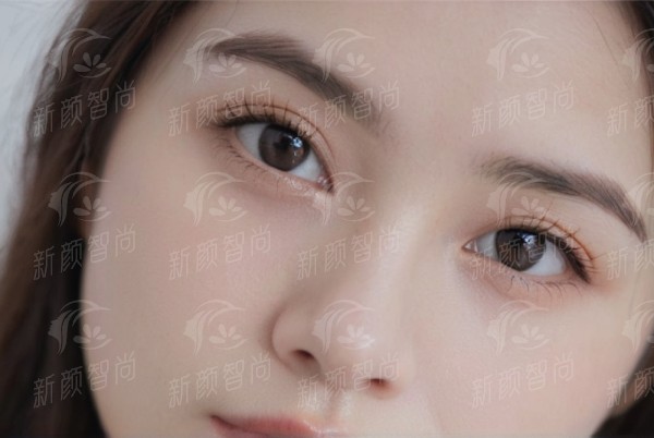 二、温州艺星医美口腔医院 | M22黄金超光子核心优势