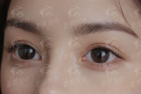 三、在天津美莱做伊妍仕要多少钱？