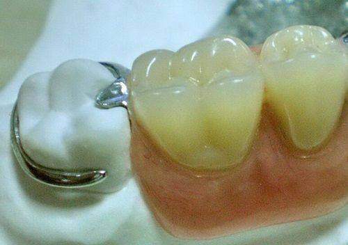 四、【丹东德立联合口腔医院】到院全流程指南