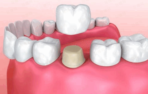 四、【无锡贝壳口腔】到院就诊全流程指引