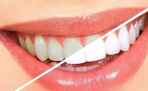 五、【重庆垫江西 南首大牙博士口腔】预约高频问题解答