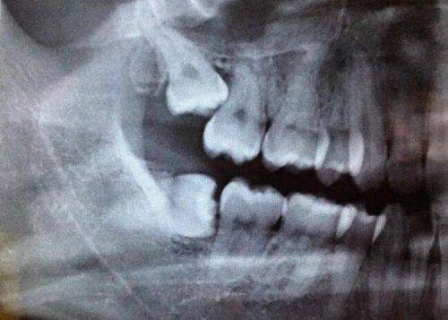 四、【无锡锡山东港安澜口腔】预约后到院流程解析