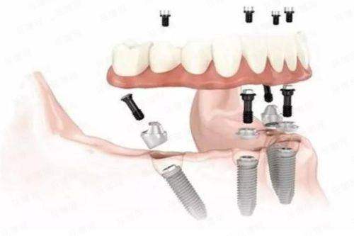 别再愁约不到！揭秘福州海狸家口腔（师大附中店）4大预约流程，新颜智尚小程序预约更省心