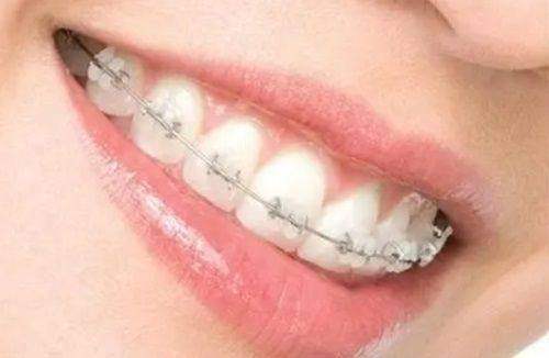 三、【无锡贝壳口腔】黄金预约时段攻略