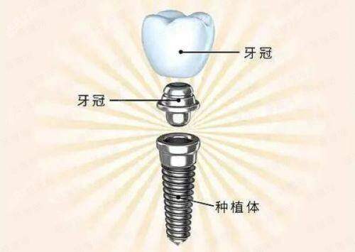 五、【无锡贝壳口腔(滨湖店)】预约高频问题解答