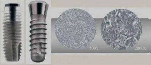 五、【无锡锡山东港安澜口腔】预约常见问题与避坑提醒