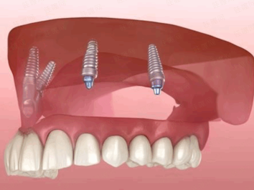 三、福州海狸家口腔（屏东店）预约时间怎么选？避开高峰更效率高
