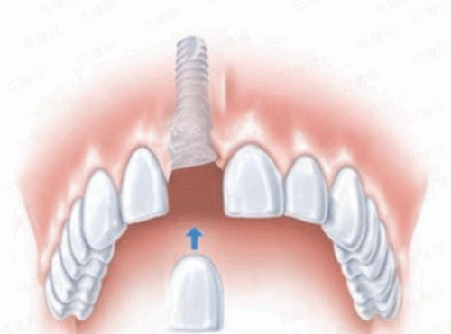 5步搞定！无锡贝壳口腔(欣惠店)预约流程全解析，新颜智尚小程序预约挂号更便捷！