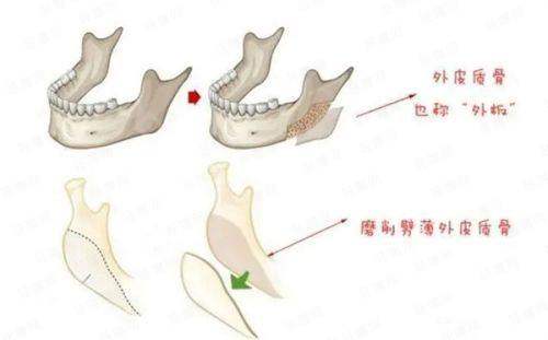 4种常见预约坑，让你在呼和浩特善美医疗美容诊所约不到心仪医生？上新颜智尚小程序挂号不踩坑，快速搞定预约！