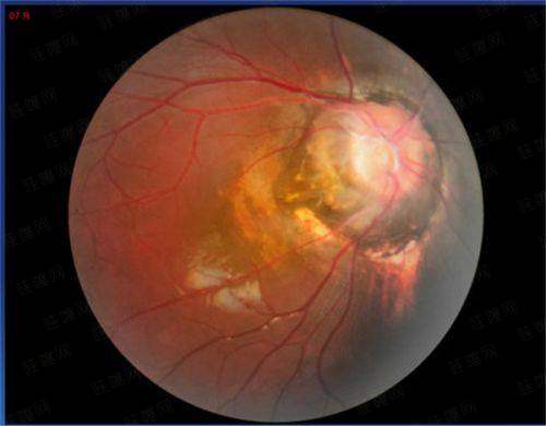 现在预约还能享受这些专属补贴