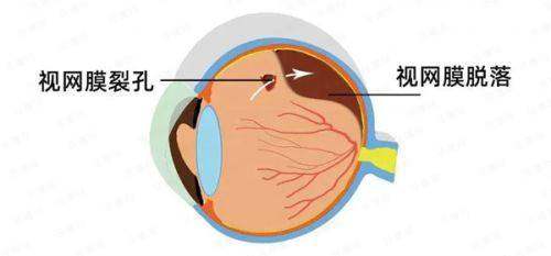 四、【日照博恩眼科医院】到院就诊全流程指南