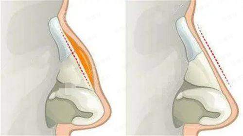四、【呼和浩特善美医疗美容诊所】到院全流程指引