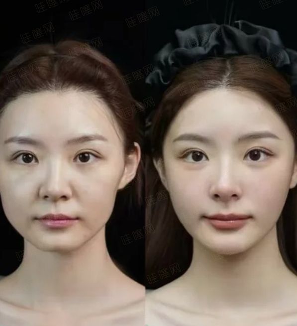 三、【呼和浩特善美医疗美容诊所】黄金预约时段攻略