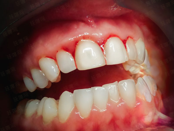 四、到院就诊全流程指引