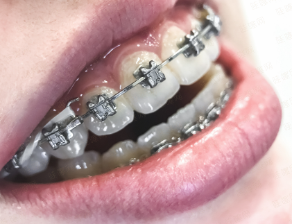 3大预约痛点全攻克！丹东德立联合口腔医院预约流程全解析，上新颜智尚小程序挂号不踩坑